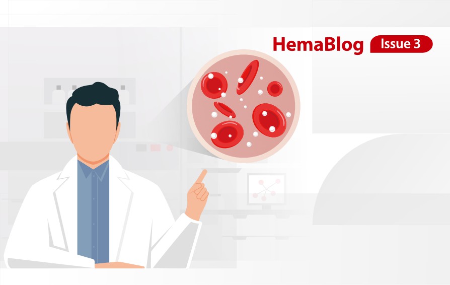 A Case Study of Acute Lymphocytic Leukemia (ALL)