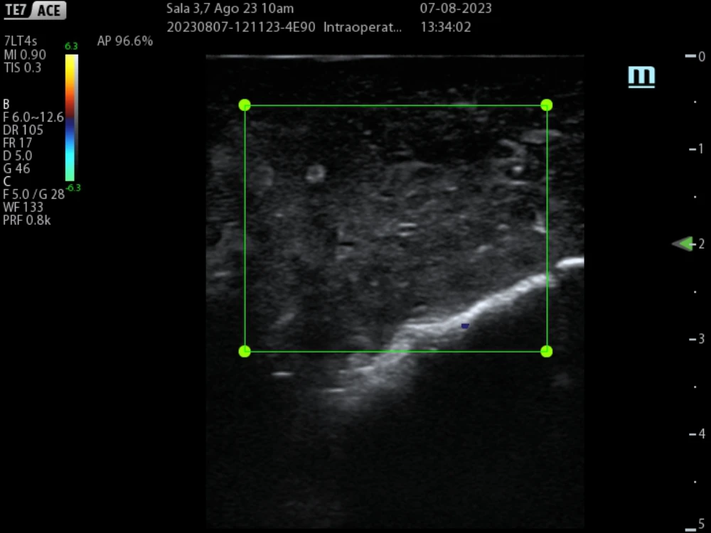 non-crirrhotic-liver-fig6