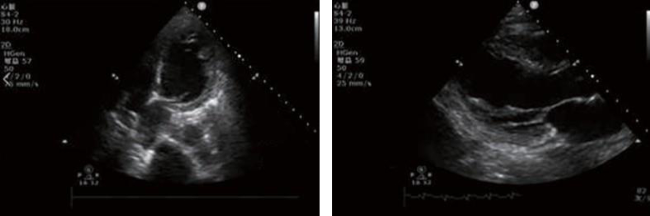 pheochromocytoma-fig1-pc