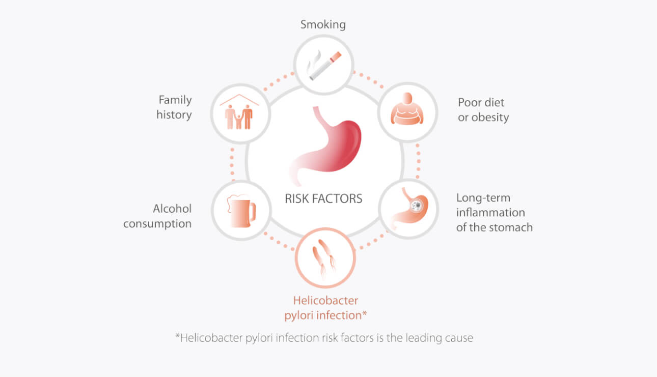 gastic-cancer-fig-5