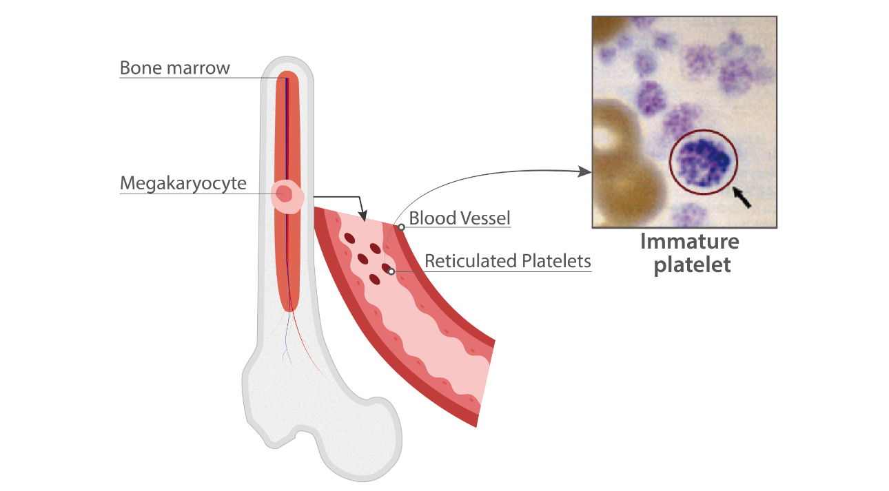 ipf-fig3-pc