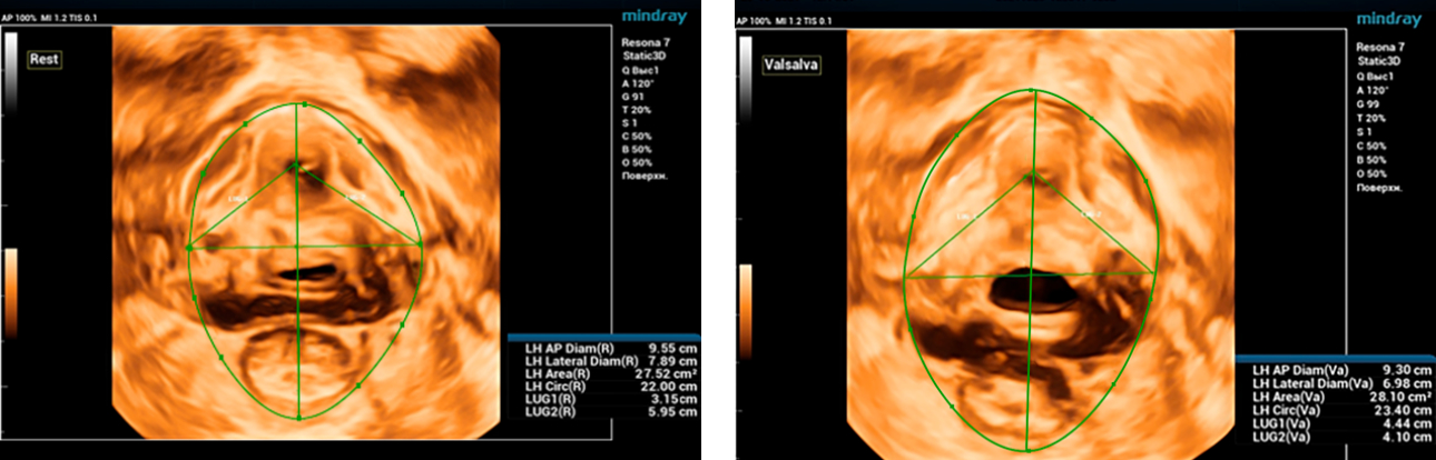 latent-urinary-fig1-pc