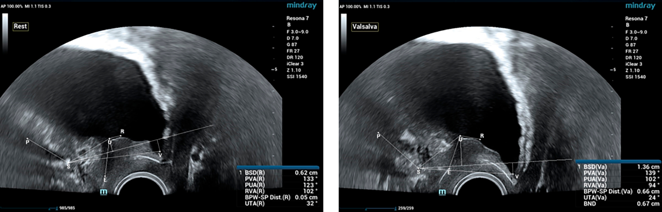 latent-urinary-fig2-pc