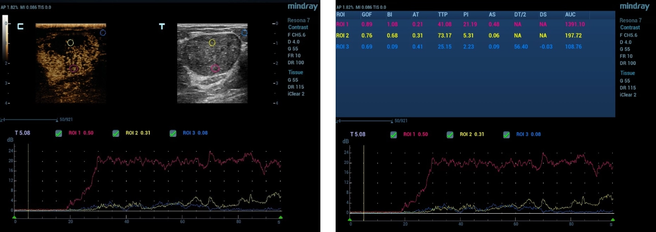 mammary-gland-fig6-pc