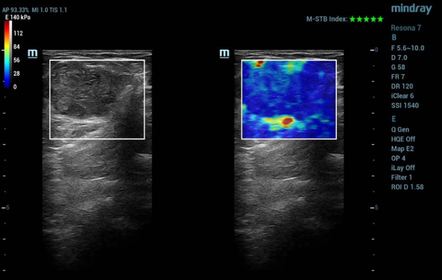 mammary-gland-kv-pc