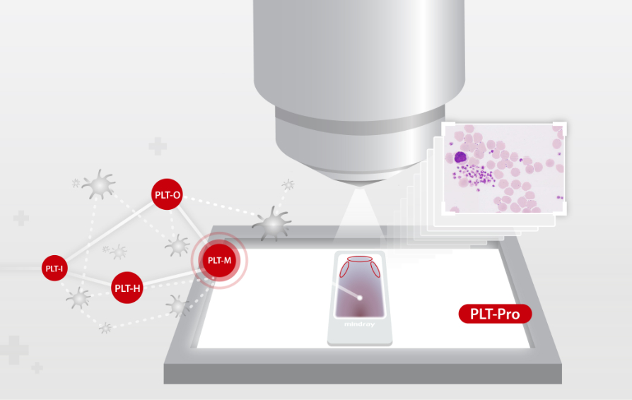 platelet-count-innovation-kv-pc