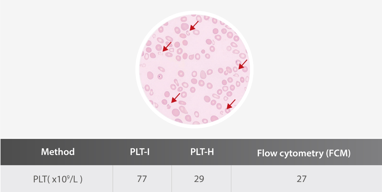 plt-h-parameter-fig5-pc