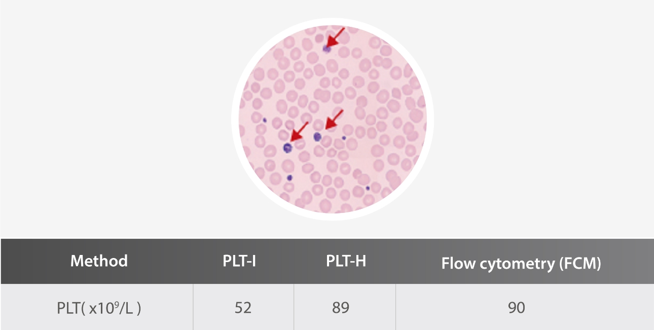 plt-h-parameter-fig8-pc