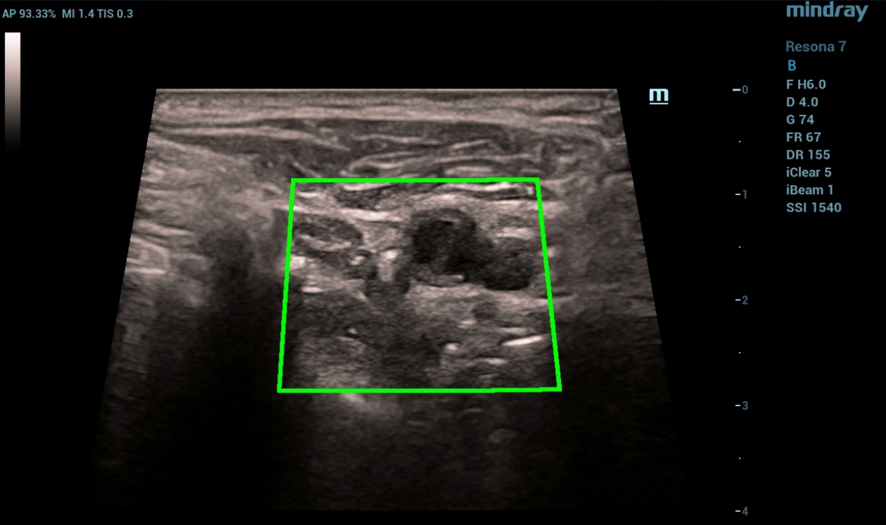 cardiovascular-pathology-fig2