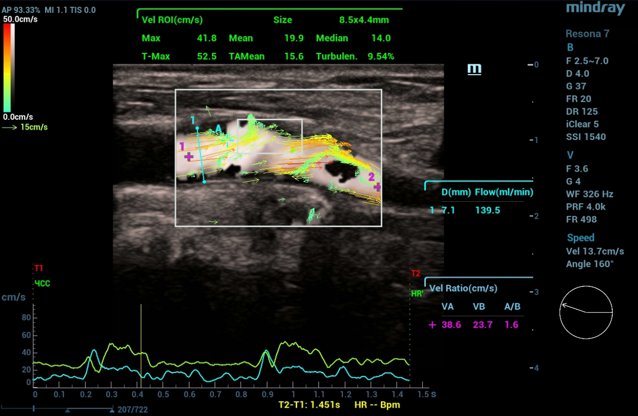 cardiovascular-pathology-fig5