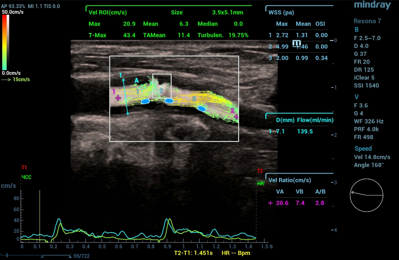 cardiovascular-pathology-fig6