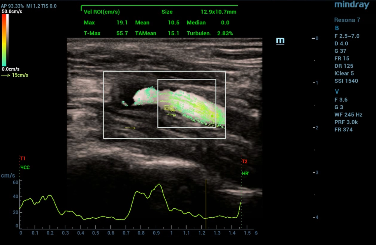 cardiovascular-pathology-fig7