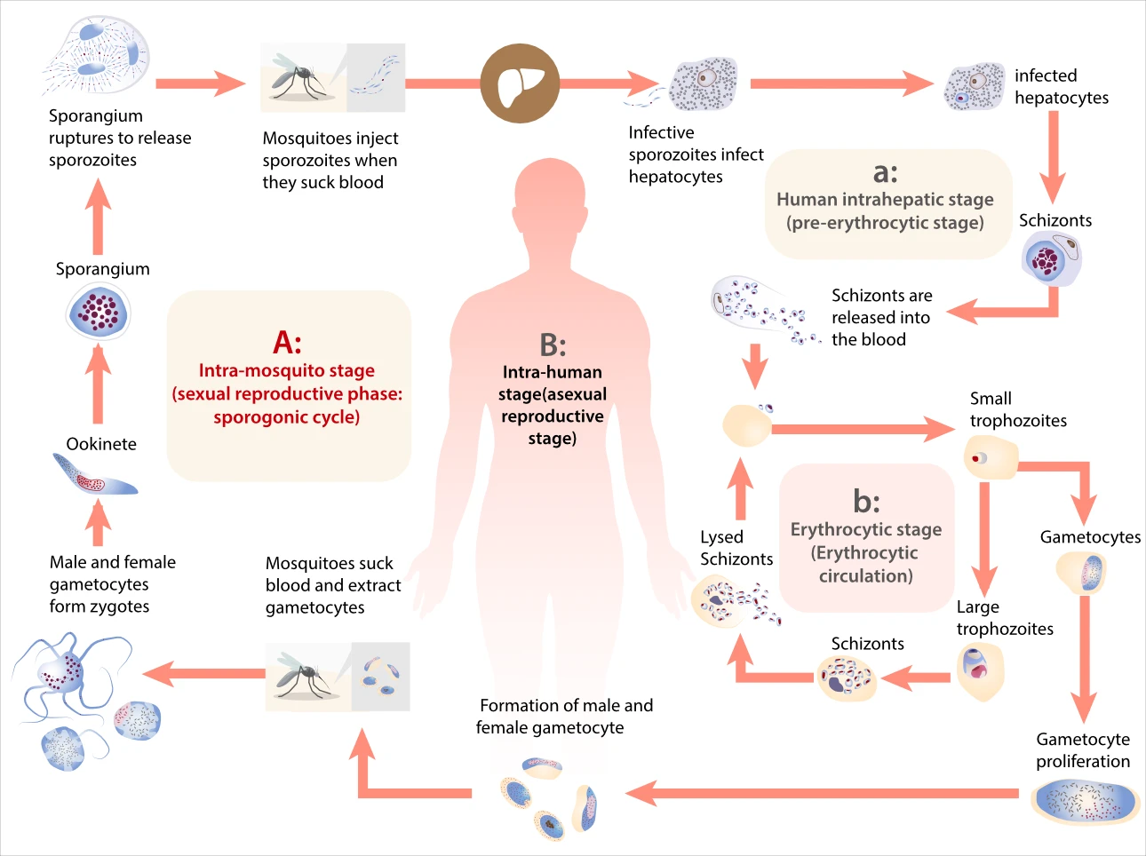 thrombocytopenia-fig6