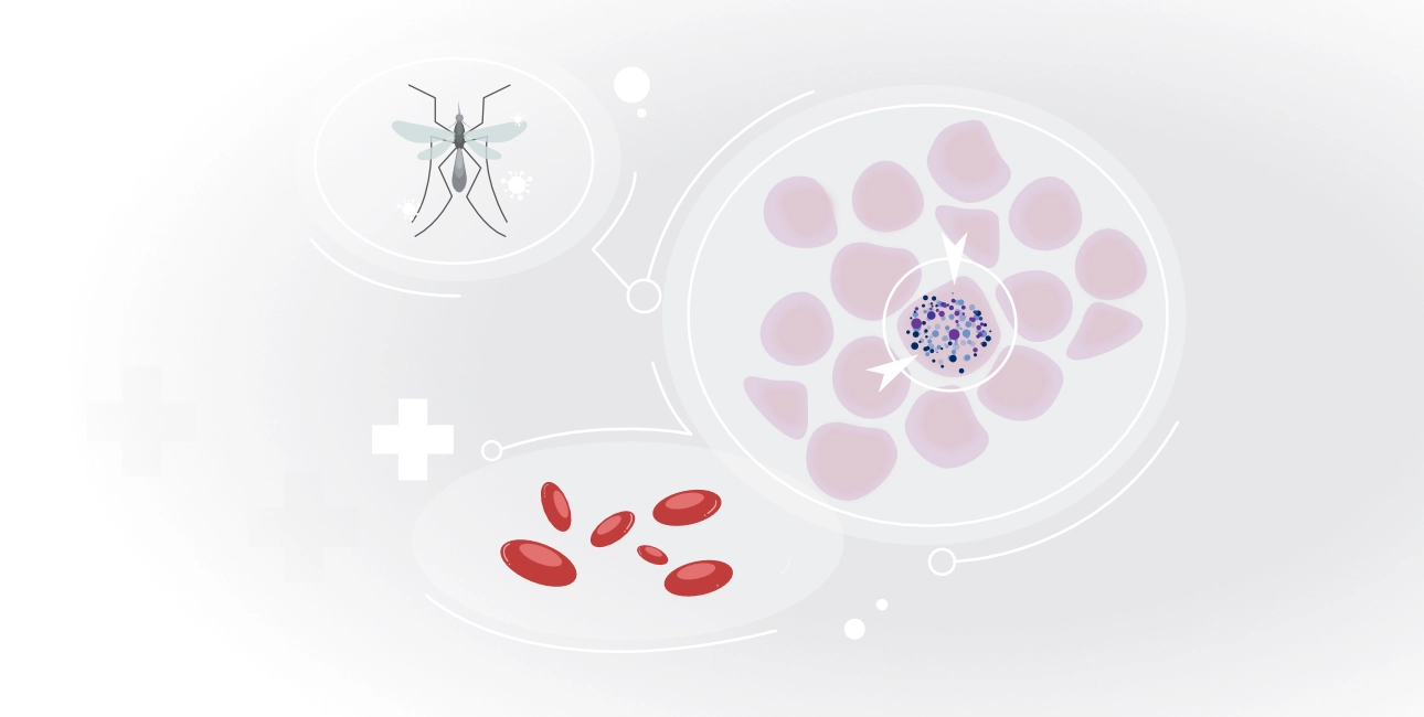 thrombocytopenia-fig7