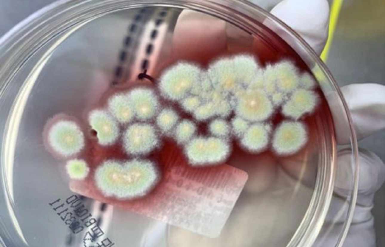 talaromyces-marneffei-fig6-pc