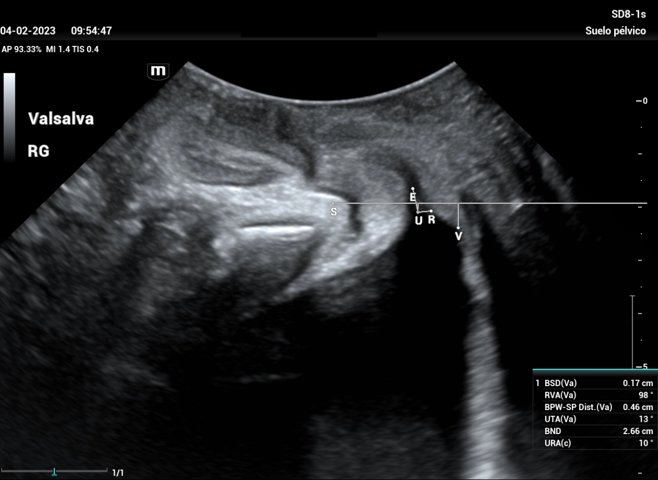 stress-urine-fig2