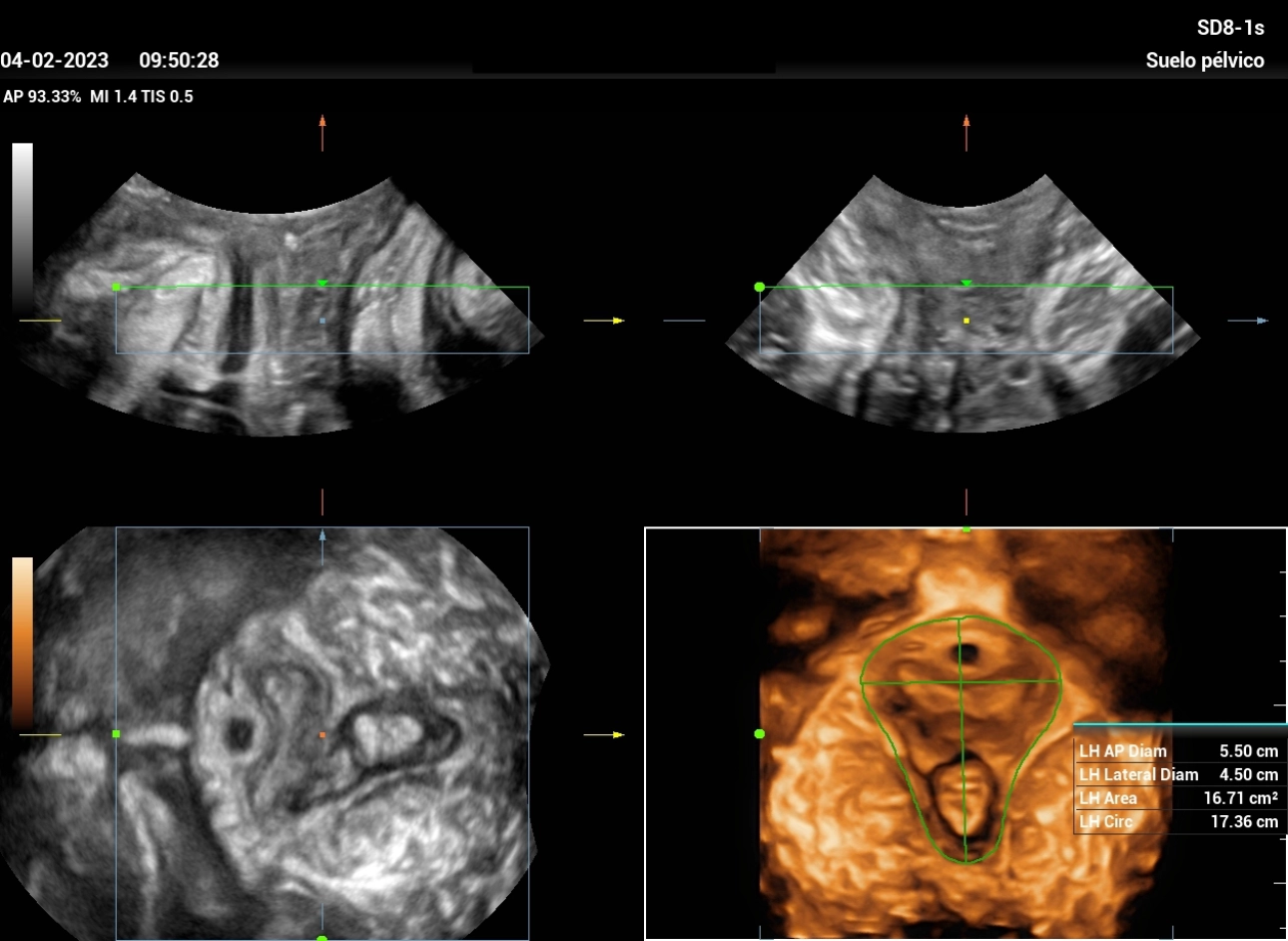 stress-urine-fig4