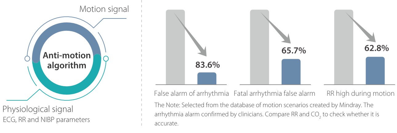 mWear wearable patient monitor: Effective reduction of the clinical alarm load