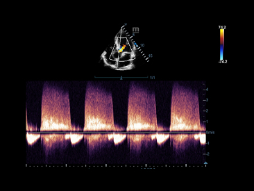 p87-s6-1