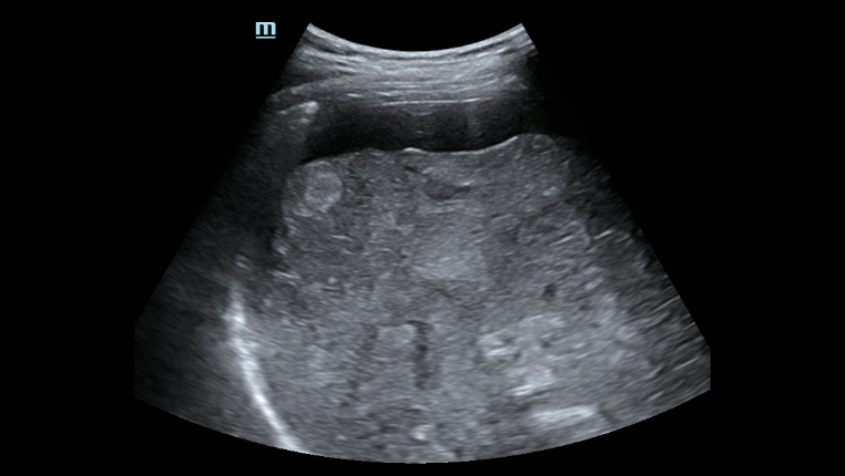 hepatus-series-fig10-2-pc