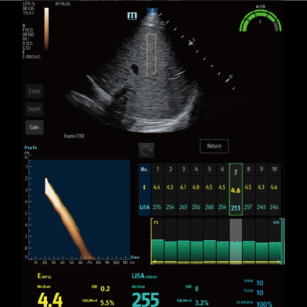 hepatus-series-fig5-pc