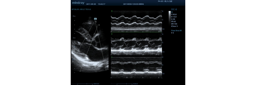 m9-fig8-pc