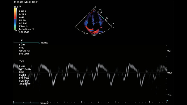 consona-n6-fig3-3-2