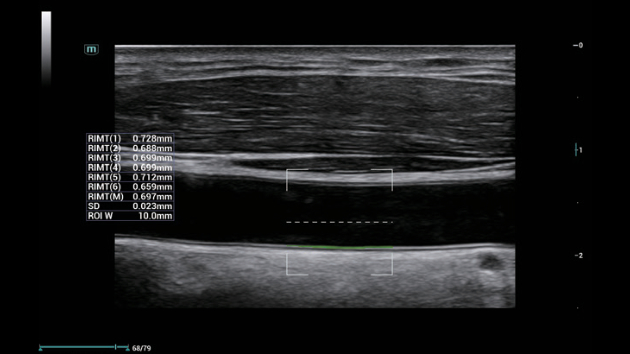 consona-n6-fig3-3-3