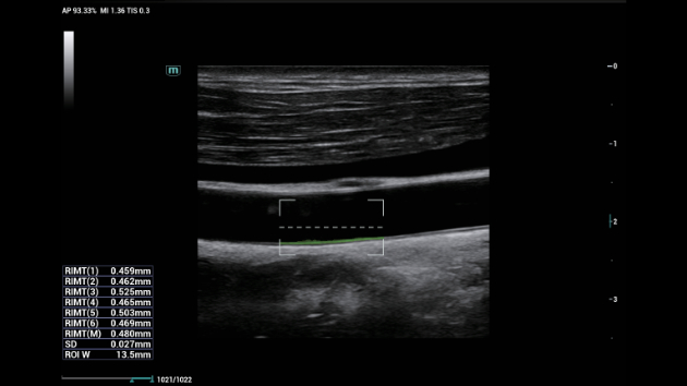 consona-n9-fig3-3-3