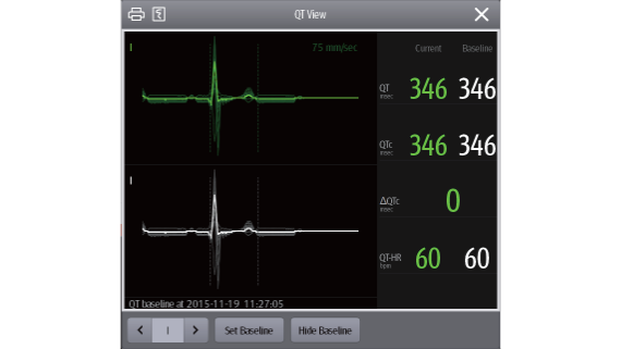 ccu-fig4-5-pc