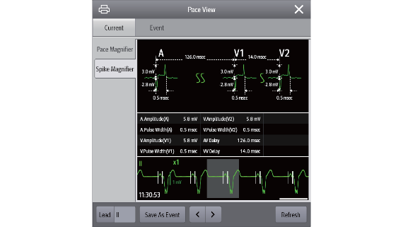 ccu-fig4-6-pc