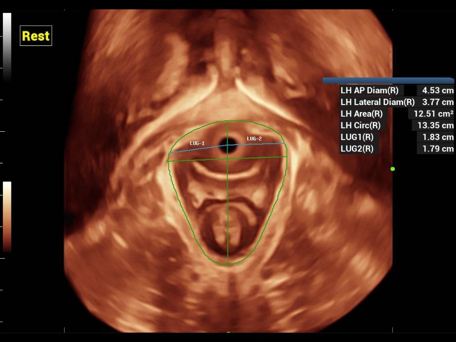 female-pelvic-fig1-2-pc