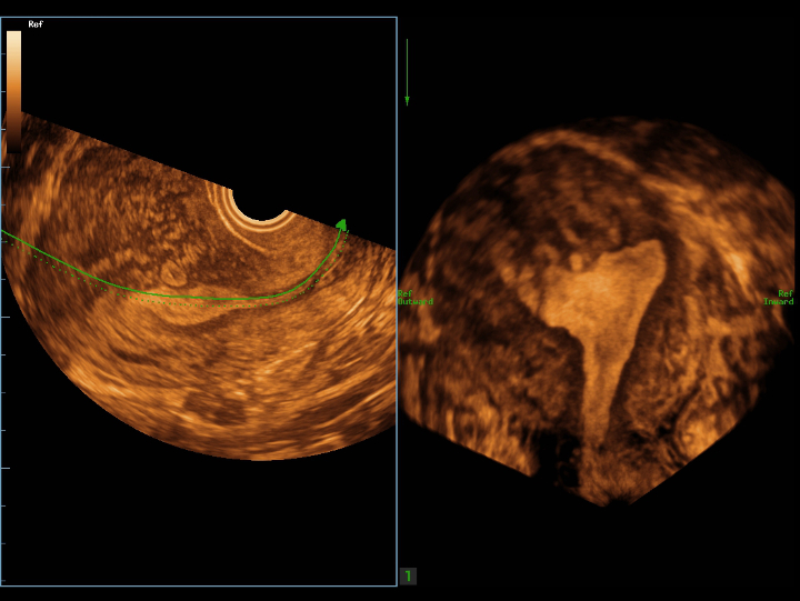 gynecology-fig3-1