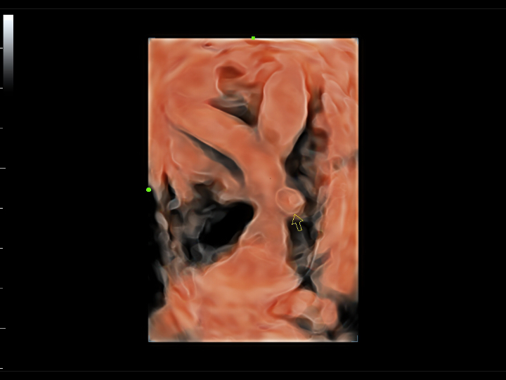 gynecology-fig3-5