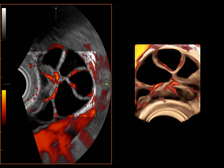 gynecology-fig3-8