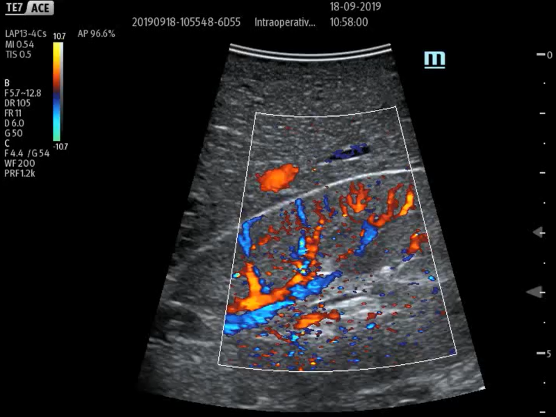 TE7 Ace Kidney hemodynamics 800x600