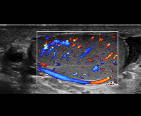 Testicle-Perfusion