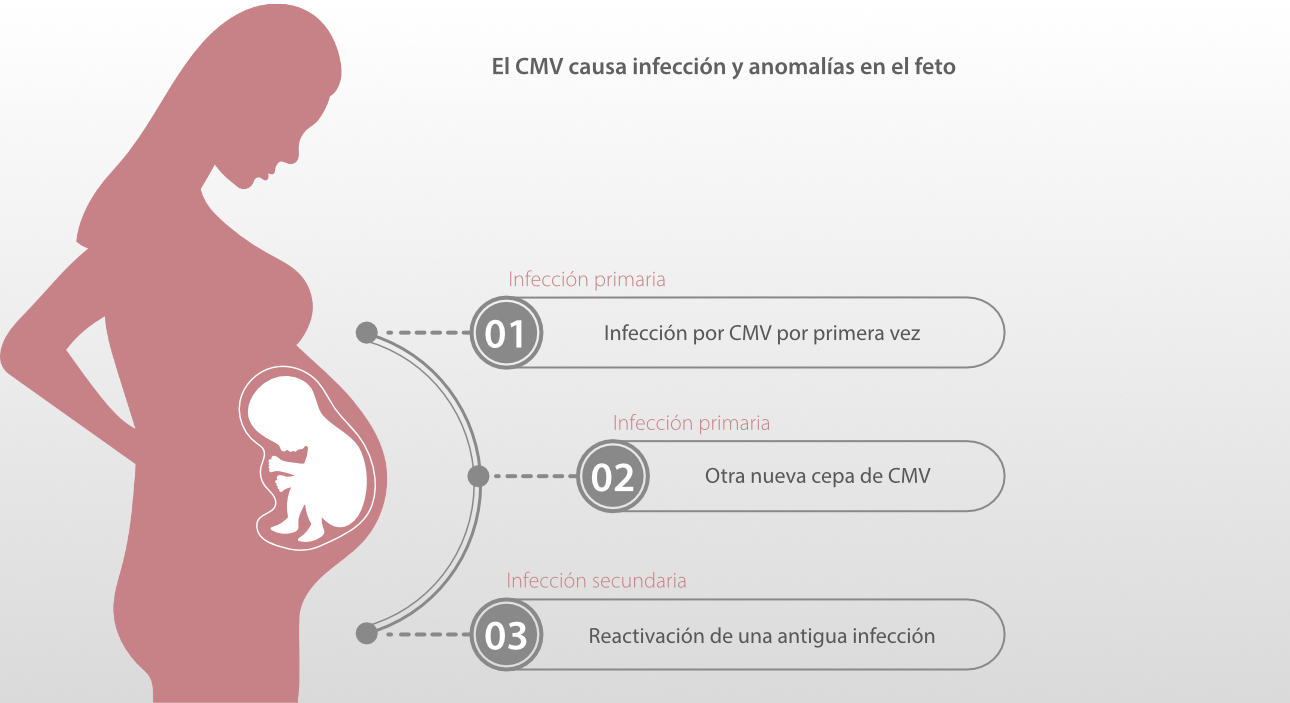 cytomegalovirus-fig2-pc-es-la