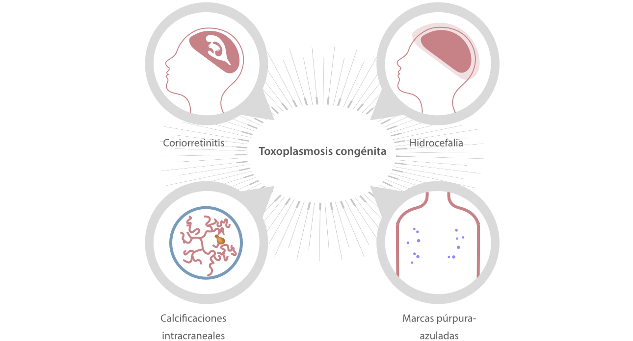 toxoplasmosis-fig3-pc-es-la