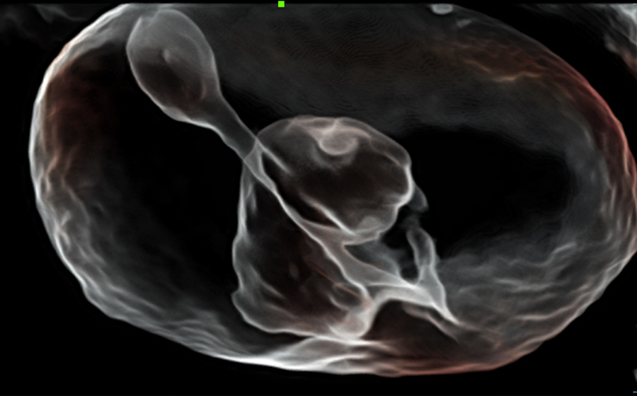 Fetal heart  flow