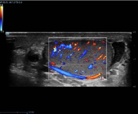 Testicle-Perfusion