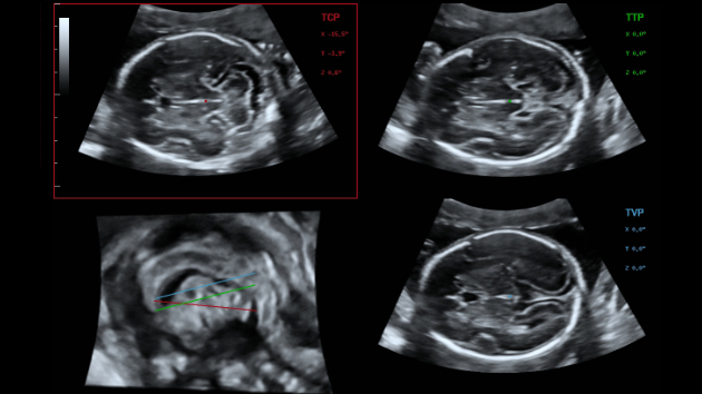 consona-cn-fig3-2-3