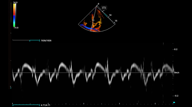 consona-cn-fig3-3-1