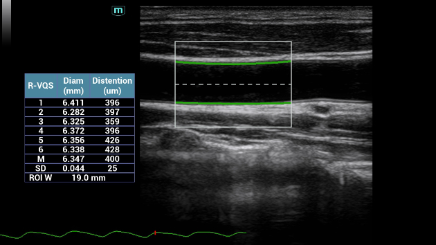 consona-cn-fig3-3-4