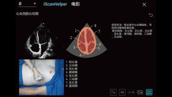 consona-cn-fig4-1-pc