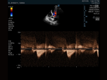 zhg1039-s6-27