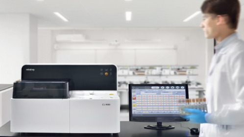 Chemiluminescence Immunoassay