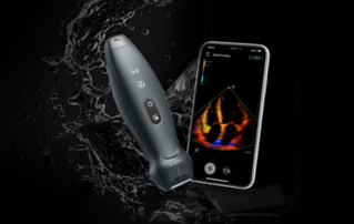 Mindray opens online store for its wireless handheld ultrasound system, TE Air