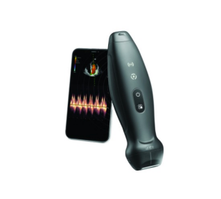 TE Air Handheld Ultrasound