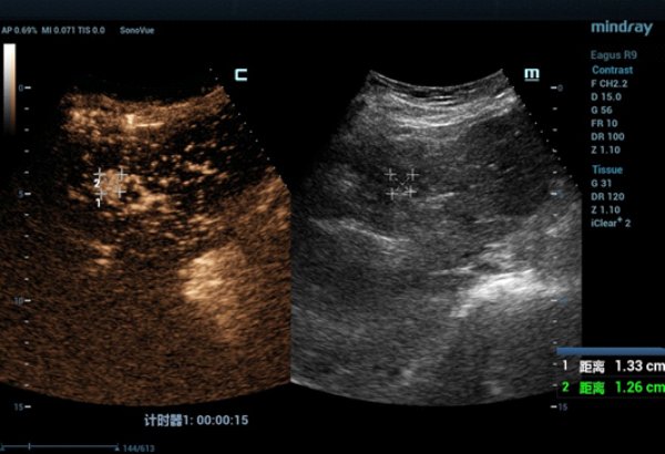 fusion-imaging-fig2